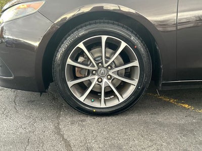 2015 Acura TLX V6 Advance